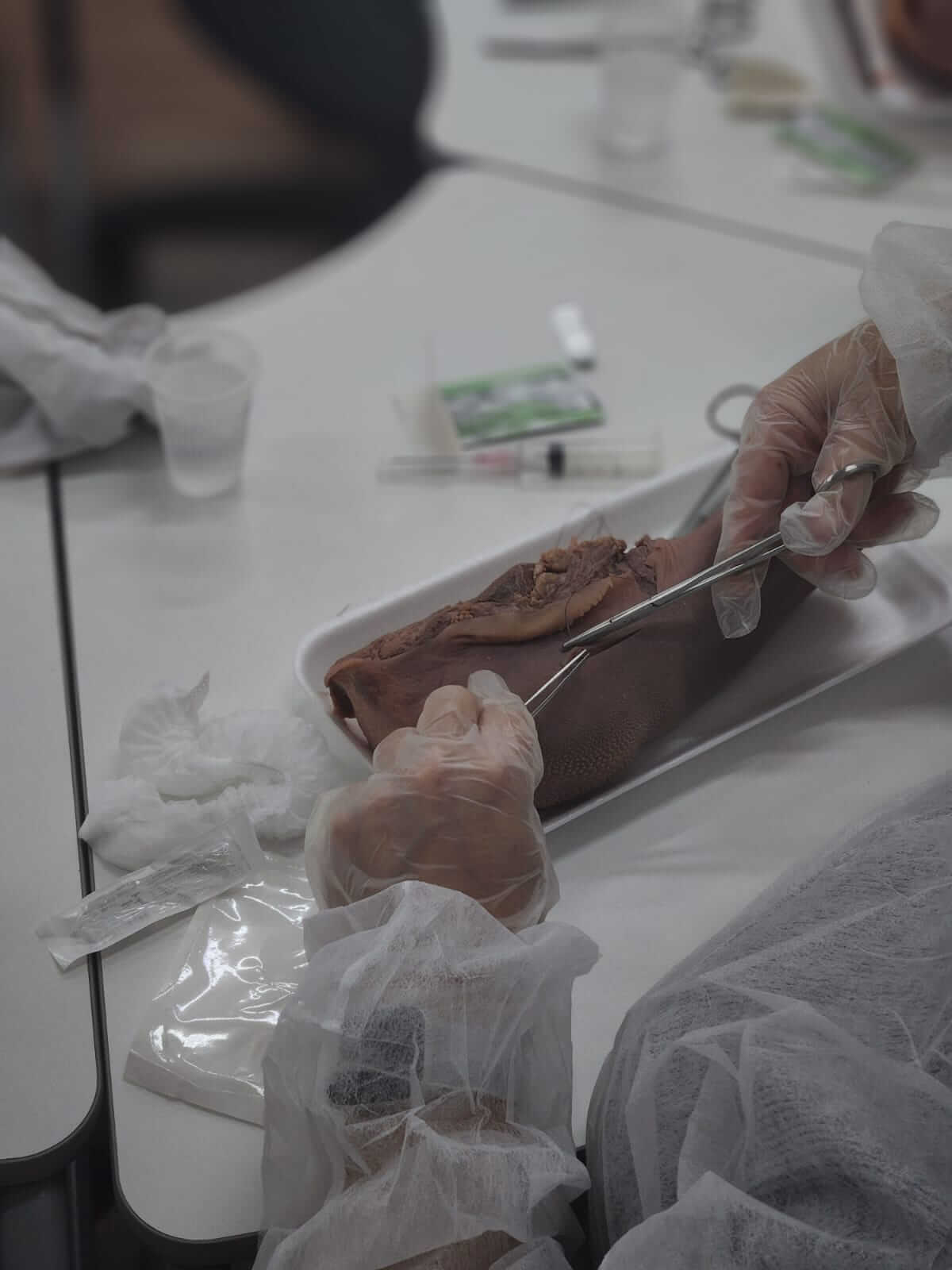 Pós em Estomaterapia em Juiz de Fora | Prática com Desbridamento e Sutura no IESPE